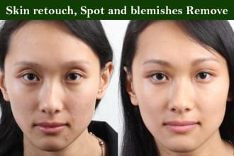 photo retouch, wrinkles, blemishes, dark circles, unwanted spots removed