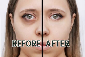 remove your eye bags, dark circles using photoshop