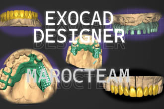 design crowns,bridges, implants, partial, using exocad