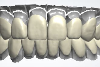 do waxup mockup and monolithic zirconia design using 3shape