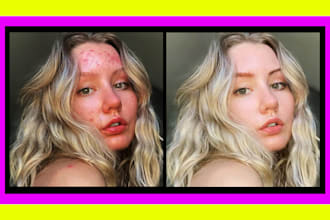 remove blemishes, object deletion and edit any picture also add watermark