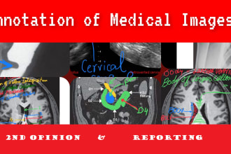 annotate, describe and make flashcards of radiology imaging
