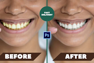 do teeth whitening using photoshop in just 1 hour