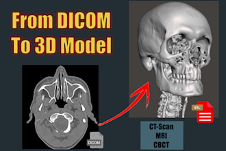 create a 3d model from your ct or mri dicoms