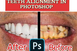 whiten teeth, fix and align them using photoshop