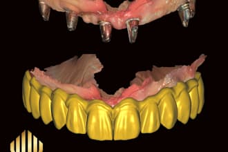 make your cad dental design with high quality