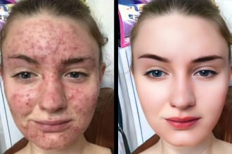 face skin retouching, remove blemishes, wrinkles, dark circles, unwanted spots