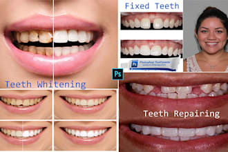 repair,fix,and whiten teeth in photoshop 100 image within 24hours