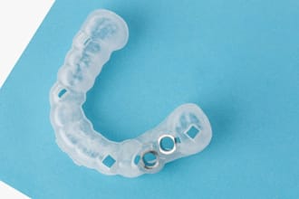 implant plan and surgical guides