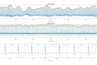 do biomedical signal and image processing