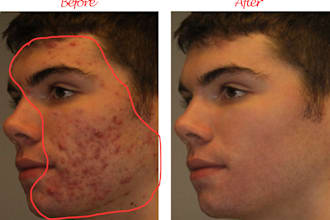do good quality retouch, face and skin modify in photoshop