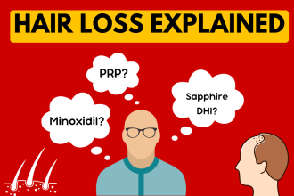 write about hair loss transplantation methods dht and more