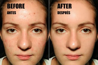 delete the imperfections on your photo