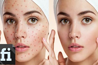 remove pimples or scar marks blemishes using photoshop