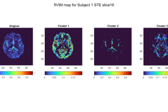 analyze your biomedical data in matlab r python