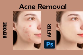 remove acne pimples and retouch your skin in photoshop
