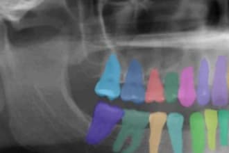 precisely annotate dental x ray images for your ai