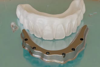 design 3d dental bar substructure