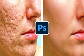 remove wrinkles, blemishes, dark circles, unwanted spots