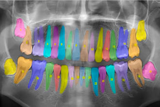 annotate dental radiology, x ray, ct and mri images