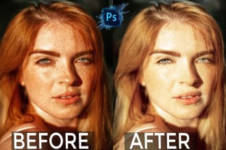 quickly remove pimples marks and dark spots, acne, from face