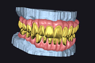 provide you excellent dental prothetic designs using exocad