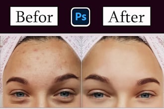 remove pimples, wrinkles, blemishes, softening in photos