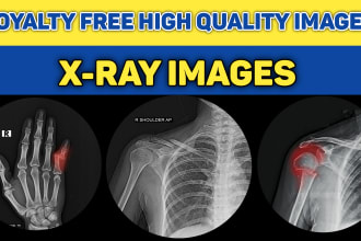 provide u loyalty free high quality x ray images as you want