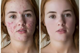 do skin retouch, headshot and high end images editing