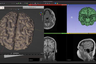 convert your ct or mri scans to 3d printable file