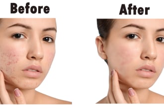 remove pimples and dark spots, retouch and clear the face