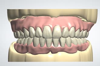 do denture design using 3shape