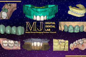 design crown and bridge dental cad in exocad