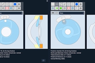 setup ophthalmology openeye software for eye care clinics