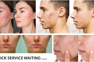 retouch your image remove pimples, wrinkles, acne and blemishes with photoshop
