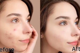 retouch your skin, pimples, wrinkles and acne in photoshop