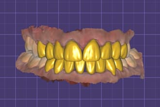 exocad design for all kind of fixed restaurations