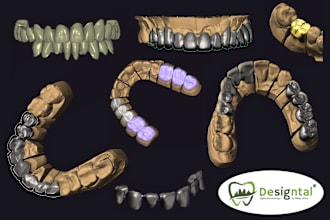 do master crafted dental design for crowns, bridges, veneers, inlays