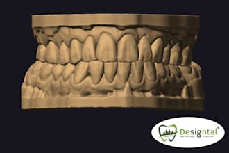 do master crafted dental design for smiledesign and waxups