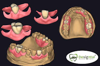 do master crafted dental design for flexidentures