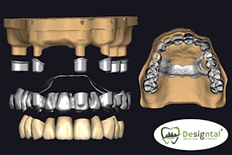 do master crafted dental design for the germancrown teleskope