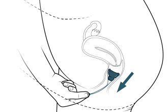 illustrate and design medical ifus