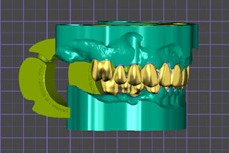 design digital dental models