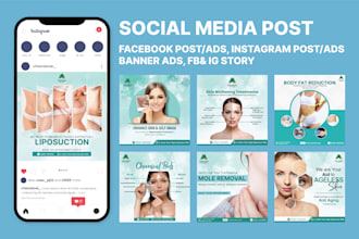 create engaging instagram and facebook posts