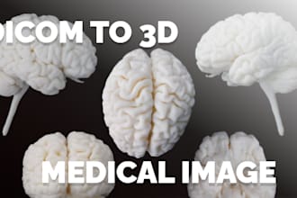 create a 3d model from your ct or mri dicom