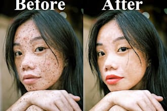 remove pimple and spot from face and body