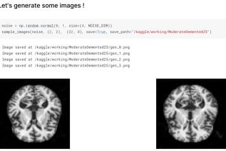 image augmentation by generative adversarial networks gan