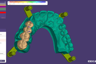elevate seamless smiles of crown bridge on exocad