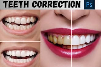 edit your teeth whiten, align and fix ,remove braces using photoshop