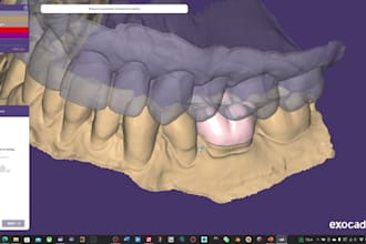 design dental prosthesis crowns and bridges in great quality by exocad